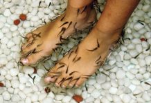 Dr Fish Therapy: Nibbles that heal Fish therapy