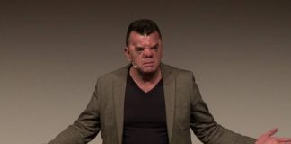 Robert Hoge: The man who owns his “ugly” face Robert Hoge: The man who owns his face