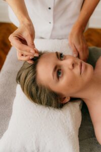 A young woman undergoing acupuncture therapy